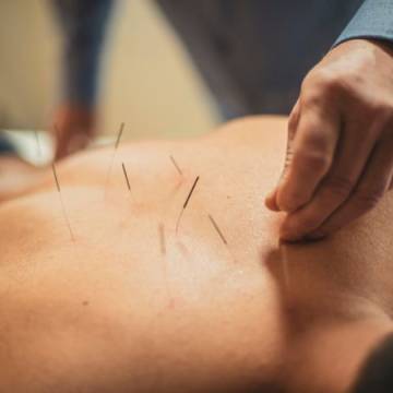 5 sposobów na zmniejszenie stresu za pomocą akupunktury i ziół